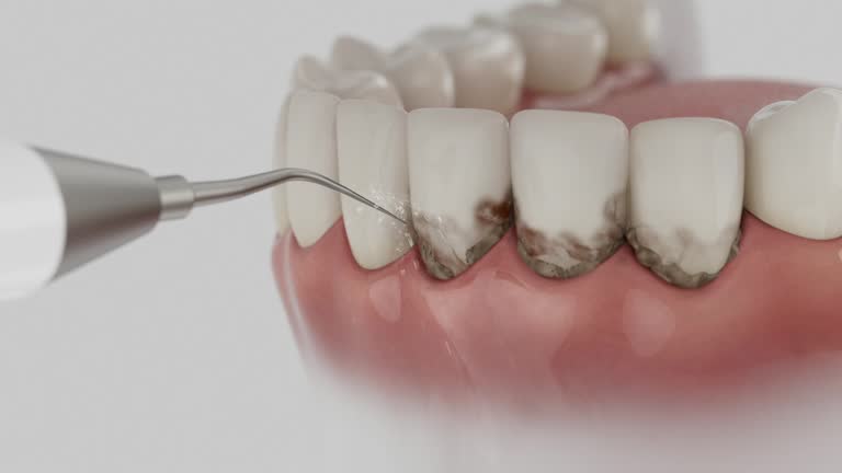 Trusted Dental Implants service in Sharon, MS - Dentist Open Now